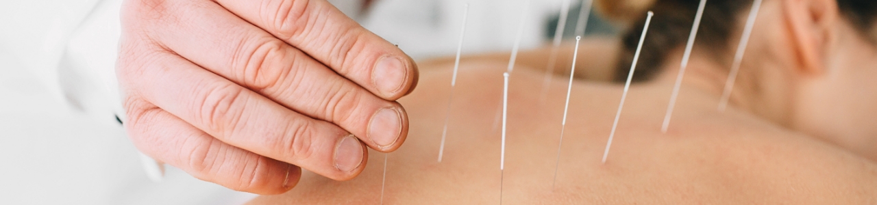 Acupuncture Vancouver, BC | West End Physiotherapy