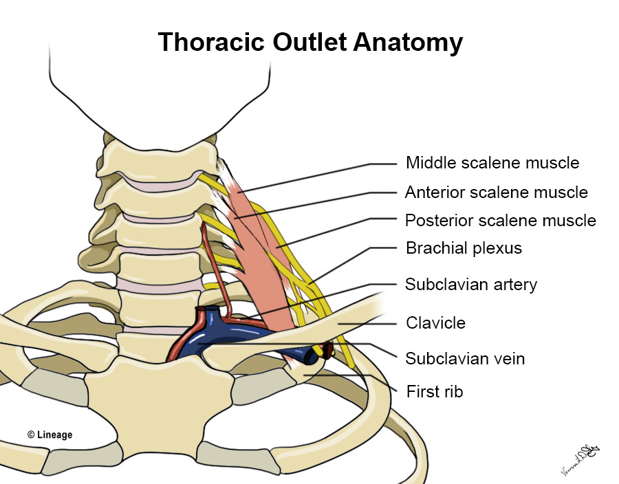 thoracic outlet cartoon anatomy drawing