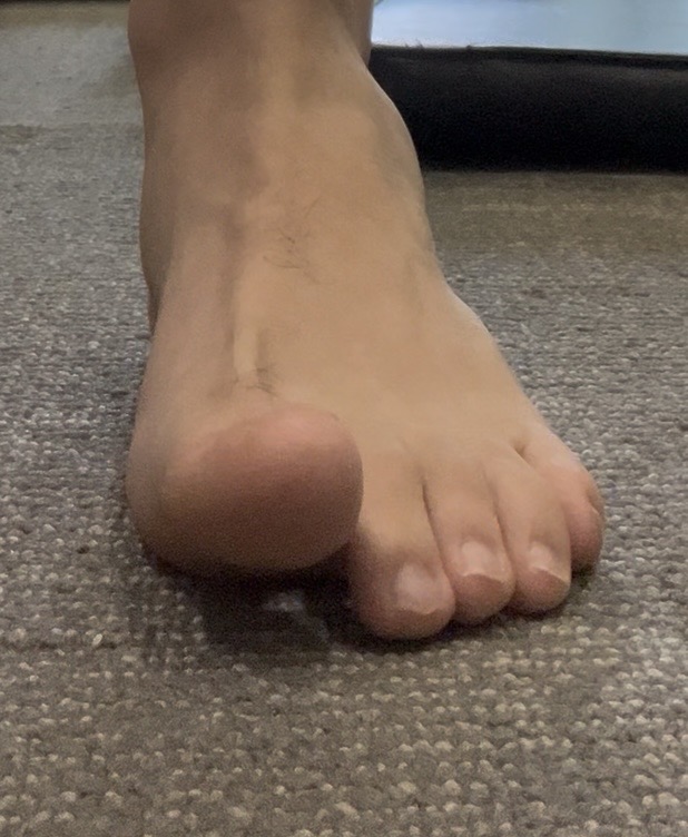 Big Toe Lifts